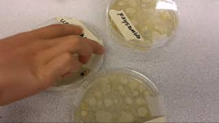 Growing bacteria in a petri dish STEM activity for kids [upl. by Demmer62]