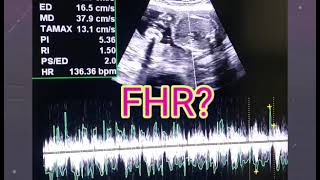 U Tell Me Baby Gender On Ultrasound 🙂  FHRV Cephalic or Breech  Placenta Posterior or Anterior [upl. by Navonoj]