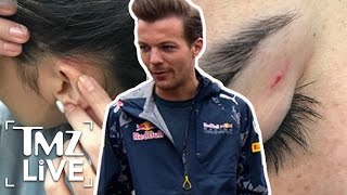 Louis Tomlinson Airport Fight Victim Speaks Out  TMZ Live [upl. by Carolyne462]