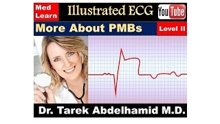 ECG 2 MORE ABOUT PMCs usmle internalmedicine cme medicaleducation ecg محاضراتباطنة medical [upl. by Ziom]