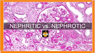 Nephritic vs Nephrotic Syndromes [upl. by Irim]