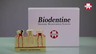 Biodentine mixing instructions [upl. by Beller]