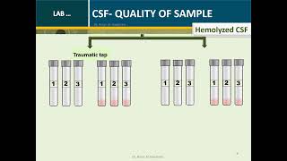 Cerebrospinal fluid Routine Analysis Microbiology Tube 2 [upl. by Busey975]