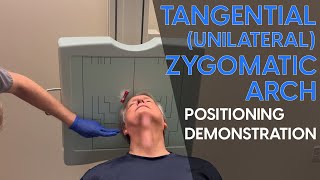 Tangential Unilateral Zygomatic Arch Radiographic Positioning Demonstration [upl. by Atiana]