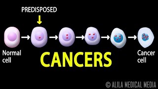 Cancer How Cancer Starts How Cancer Spreads Where and Why Animation [upl. by Alinoel]