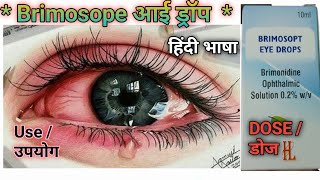 Brimosope eye drops use in hindi। Brimosope eye drops use kaise kare । viralvideoeyedrops [upl. by Elrod]