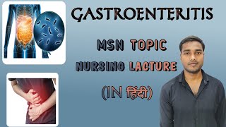 Gastroenteritisintroductiondefinition causessignampsymptomsdiagnosis managementMSN in hindi [upl. by Hugon]