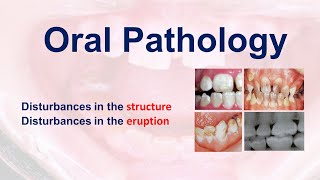 Oral Patology  LEC 2  Disturbances in the structure amp eruption [upl. by Abeu]