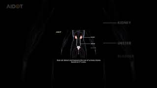 URO dot AI AI based urinary stone detection system [upl. by Hoskinson]