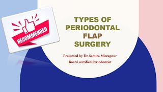 Periodontal Flap Surgery for Periodontitis [upl. by Carlita]