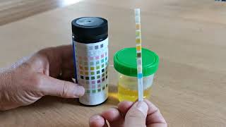 How to use urine test strips 10 parameters [upl. by Aihseit]