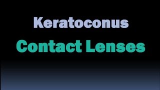 Contact lenses for Keratoconus Sclera lenses hybrid lenses RGP contact lenses  Piggybacking [upl. by Nwahsd855]