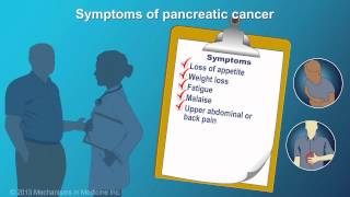 Pancreatic Cancer Signs Symptoms and Risk Factors [upl. by Etnovaj56]