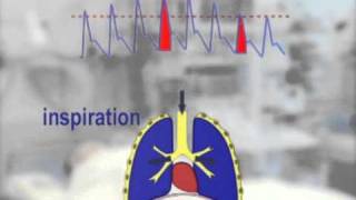 systeme picco le principe le materiel linstallation lutilisationet interpretation des resultats [upl. by Orabelle]