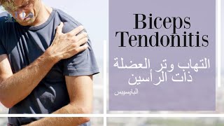 التهاب وتر ذات الرأسين العضدية biceps tendonitis subtitled [upl. by Vina]