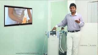 Best Nonsurgical skin tightening and body contouring machine now at Chennai Plastic Surgery [upl. by Akemaj]