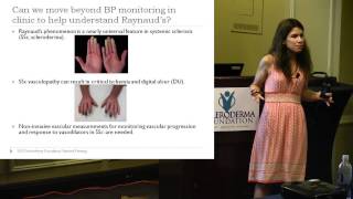 2015 Nashville How Do We Track Vascular Changes in a Scleroderma Clinic Dr Tracy Frech [upl. by Margherita]