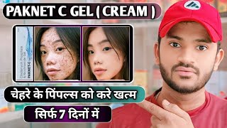 Paknet c gel uses dose benefits and Side effects full review in hindi [upl. by Isborne381]