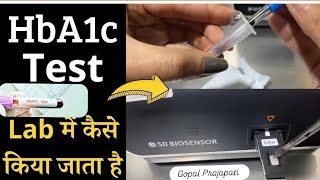 HbA1c test full procedureHbA1c test कैसे किया जाता हैं HbA1c test by SD BIOSENSER f200 Dr Gopal [upl. by Eenyaj]