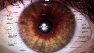 Iridology Reading Part I [upl. by Mia]