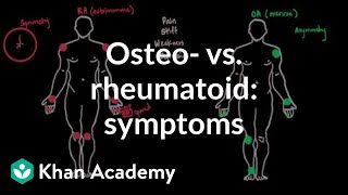 Osteoarthritis vs rheumatoid arthritis symptoms  NCLEXRN  Khan Academy [upl. by Cleres]