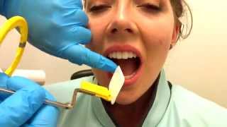 How to Take Periapical Radiographs [upl. by Bryanty]