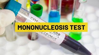 Mononucleosis Test  My Lab Solution [upl. by Troyes474]