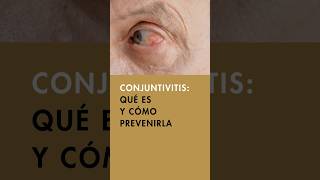 👀 Todo sobre la Conjuntivitis síntomas causas y tratamientos efectivos  Ojo rojo y cuidado ocular [upl. by Brice]