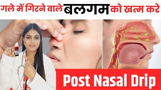 PostNasal Drip Homeopathic Treatment  गले में बलगम का गिरना  Causes Symptoms amp Medicines [upl. by Onitram]