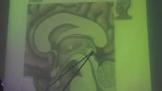 Neuroanatomy 93  Third ventricle part 2   by Dr Wahdan [upl. by Muller932]