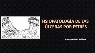 Fisiolopatología de úlceras por estrés DrVale [upl. by Kantos]