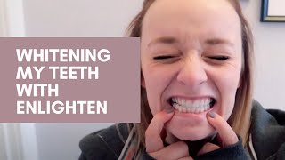 Whitening My Teeth with Enlighten [upl. by Annorah]