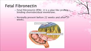 Preterm Labour [upl. by Shipley]