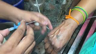 Aunty Cannulation  intravenous iv cannula fixed [upl. by Innep]