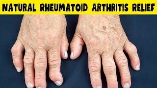 How to Treat Rheumatoid Arthritis Pain Naturally [upl. by Engracia]