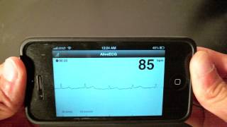 AliveCor Review by Cardiologist [upl. by Hamfurd]