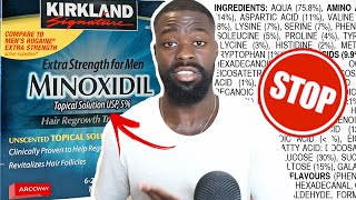 Why I STOPPED USING Minoxidil to Improve my Beard Growth  Dont use Minoxidil Before Watching This [upl. by Fidellia]