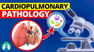 Cardiopulmonary Pathology  Heart and Lung Diseases [upl. by Post]