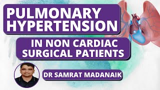 Perioperative Management of Pulmonary Hypertension in NonCardiac Surgery I Dr Samrat Madanaik [upl. by Sigrid723]