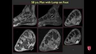 Radiology Boards Prep  More MSK Cases [upl. by Doug]