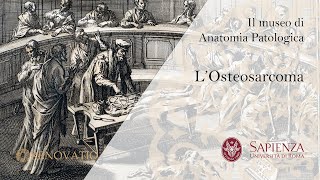 Il Museo di Anatomia Patologica  L Osteosarcoma [upl. by Einnij]