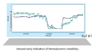 INVOS™ oximetry in the NICU Byte 11 NIRS as a guide to manage hemodynamic instability and shock [upl. by Arv]