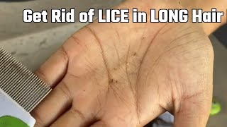 Get Rid of LICE in LONG Hair FOR GOOD [upl. by Vance]