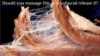 What is myofascial release  Whats the difference between myofascial release vs massage [upl. by Geminian579]