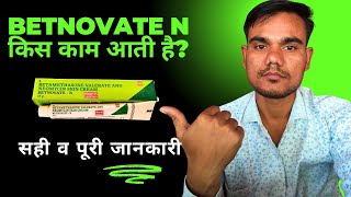 betnovate n lagane se kya hota hai  betnovate n skin cream ke fayde [upl. by Christopher]