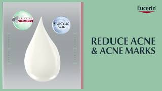 ProACNE Solution  Reduce acne and acne marks in 7 days [upl. by Harden]