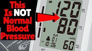 120 OVER 80 IS NOT NORMAL BLOOD PRESSURE RANGE  So What Is A Normal Blood Pressure Reading [upl. by Honig420]