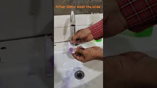 How do you quality control Leishman stain How to prepare good leishman stain for blood [upl. by Gine]