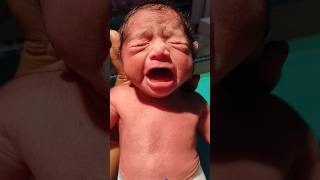 Cute IUGR baby girl 🫶❤️🫶shortvideoviraltrendingyoutubeshortsytshortsshortsdivyaverma2401 [upl. by Micco]