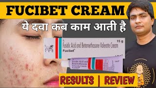 fucibet cream  fucibet cream uses in hindi  fucibet cream uses [upl. by Miller]